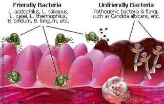 Do you have healthy gut bacteria, and does it really matter? PART 2